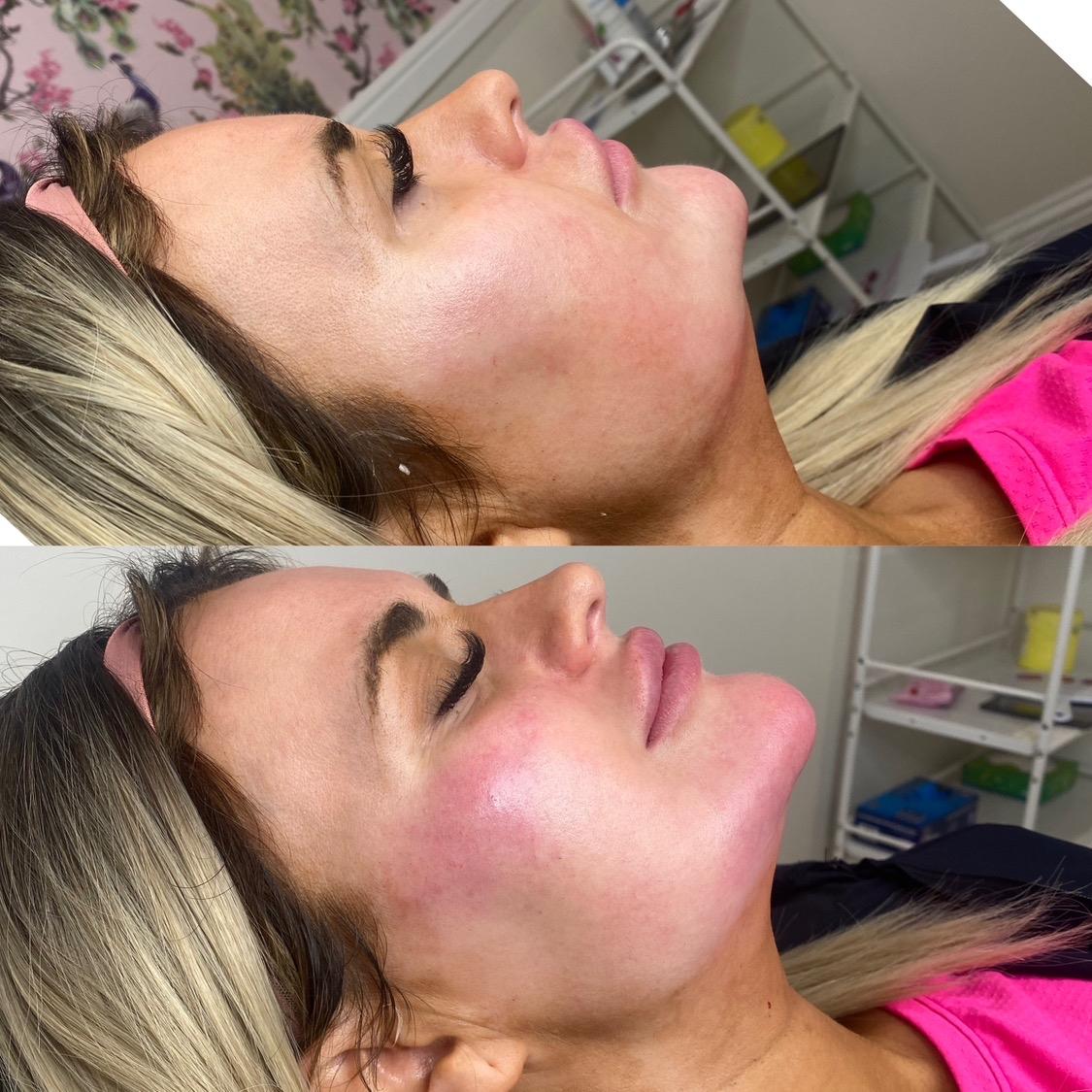 Bellissima Aesthetics image 2