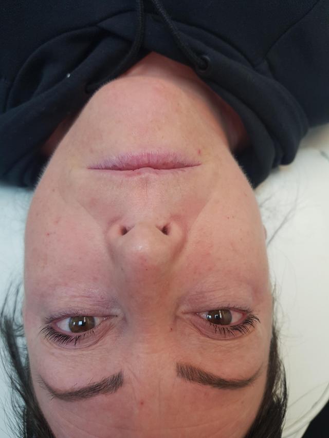 before Classic Lashes treatment