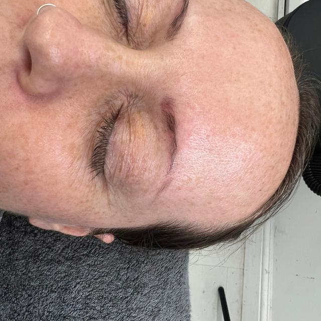 before Microblading