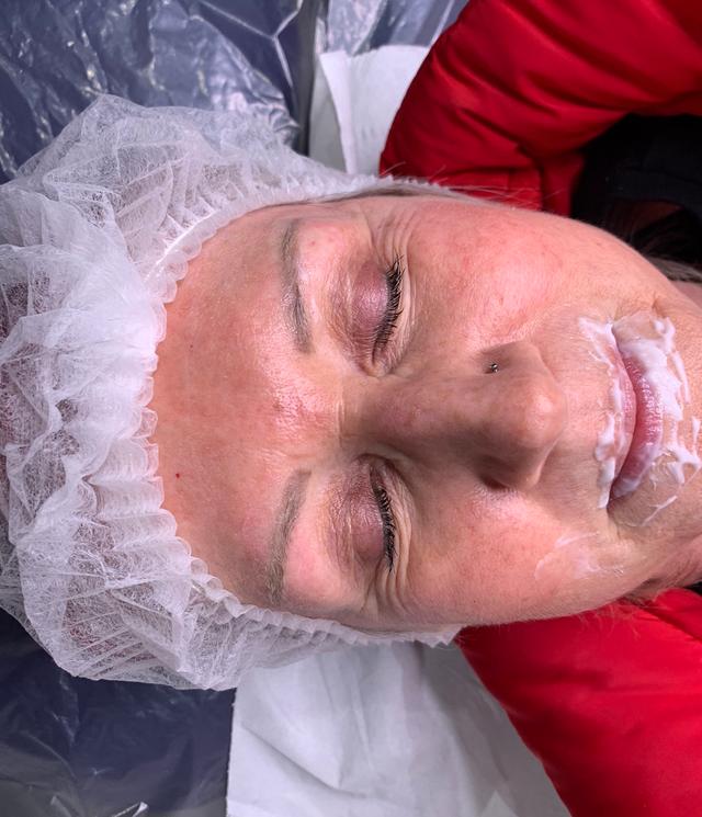 look before Eyebrow Tattoo treatment