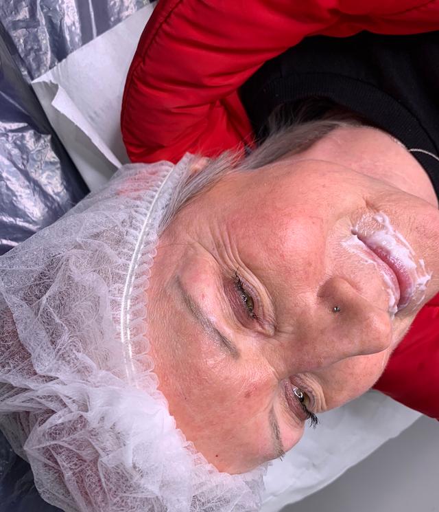 before Eyebrow Tattoo treatment