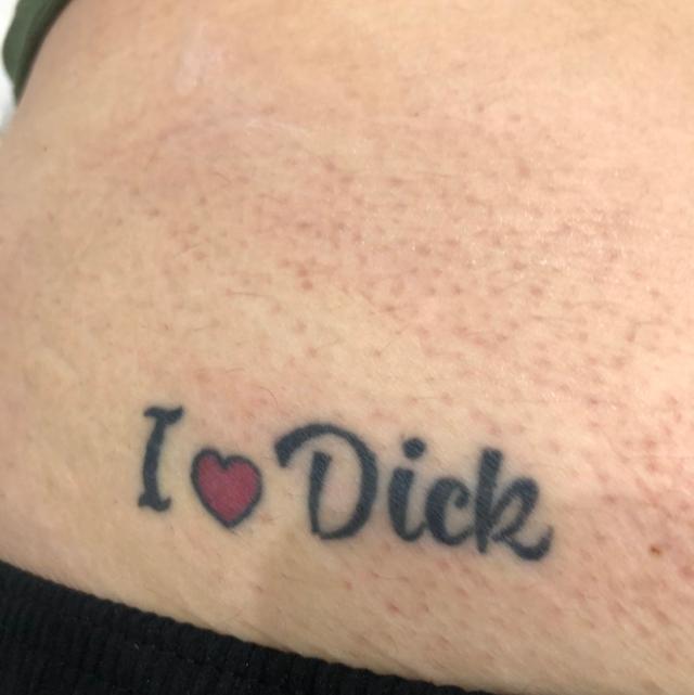 look before Laser Tattoo Removal treatment