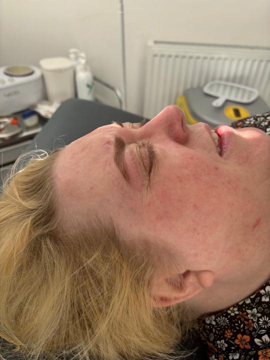 after Eyebrow Tint