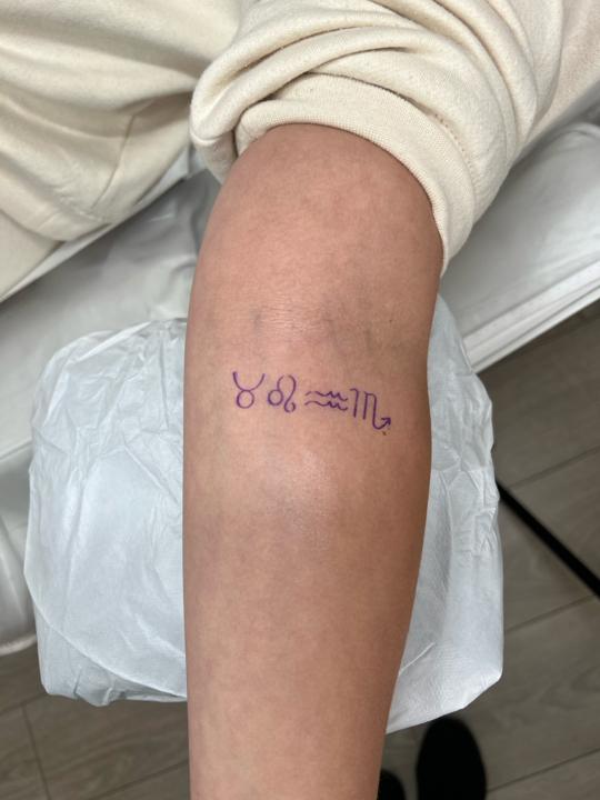 before Fine Line Tattoo treatment