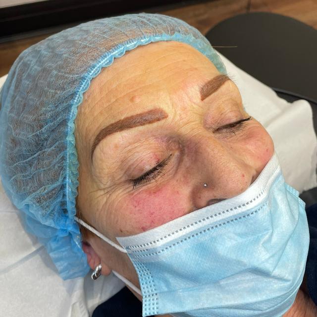 after Micro Pigmentation treatment