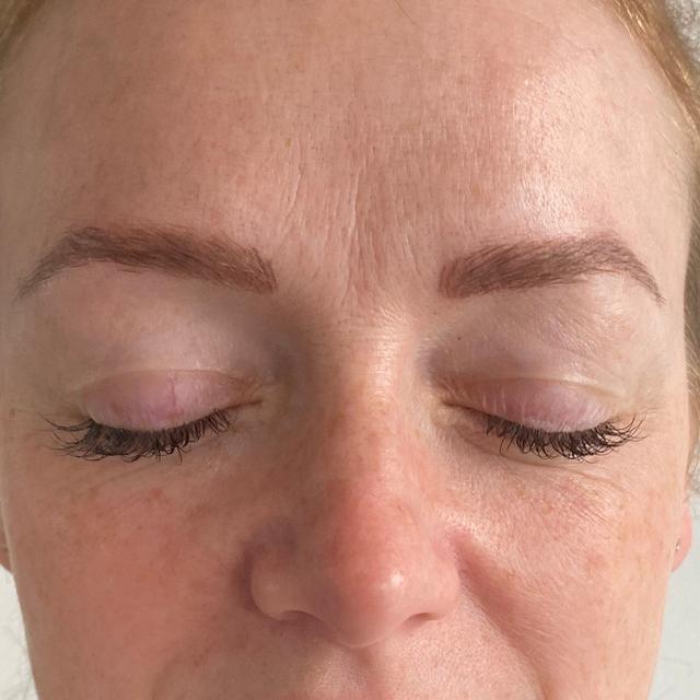 before Lemon Bottle treatment