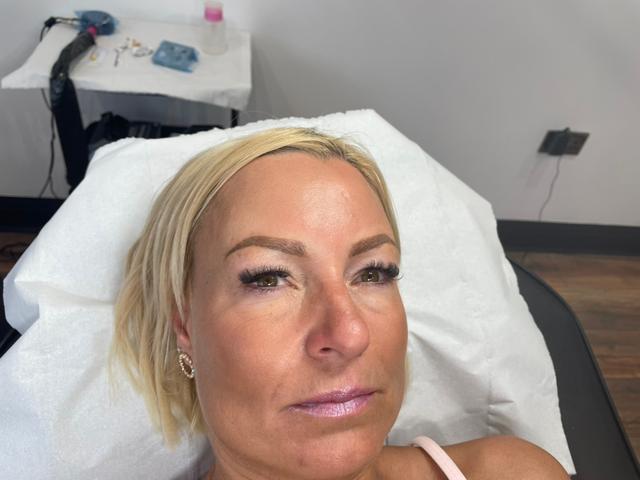 before Micro Pigmentation