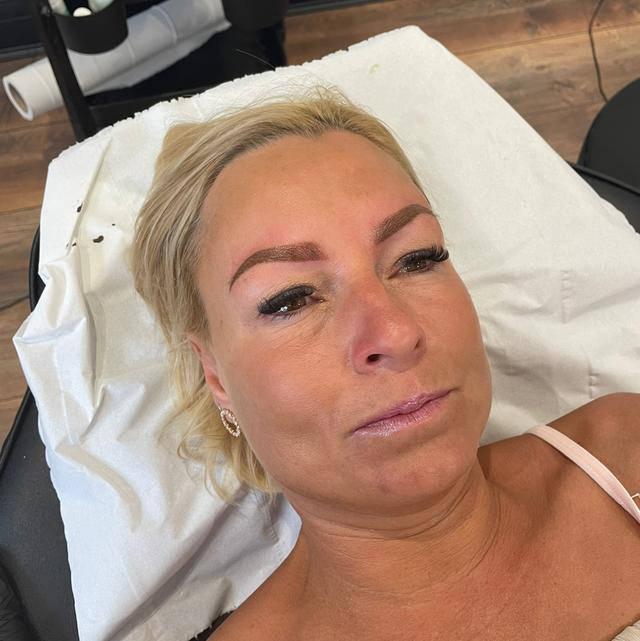 after Micro Pigmentation