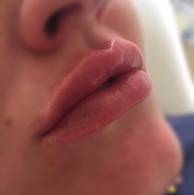 after Lemon Bottle