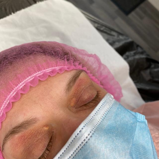before Electrolysis