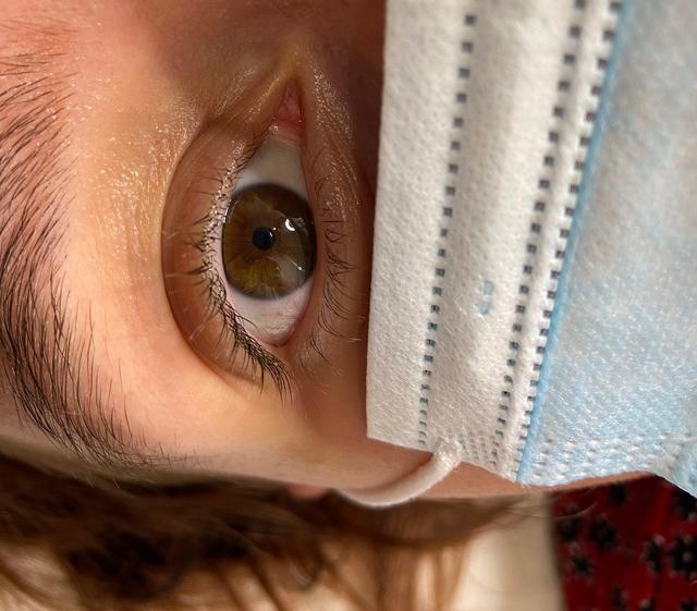 look before Classic Lashes treatment