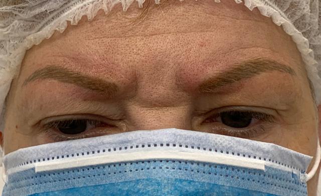 look after Body Piercing treatment
