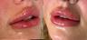 faces-image