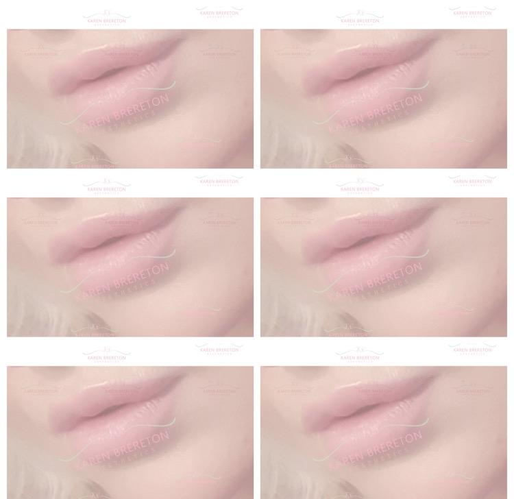 Karen Brereton Aesthetics image 1