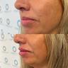 faces-image