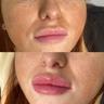 faces-image