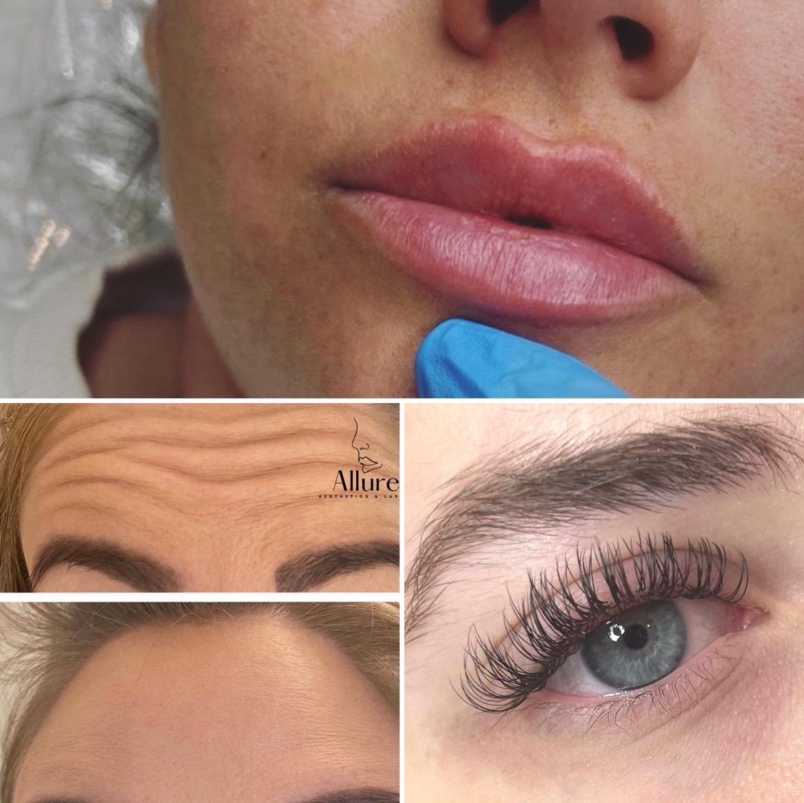 Allure Aesthetics image 1