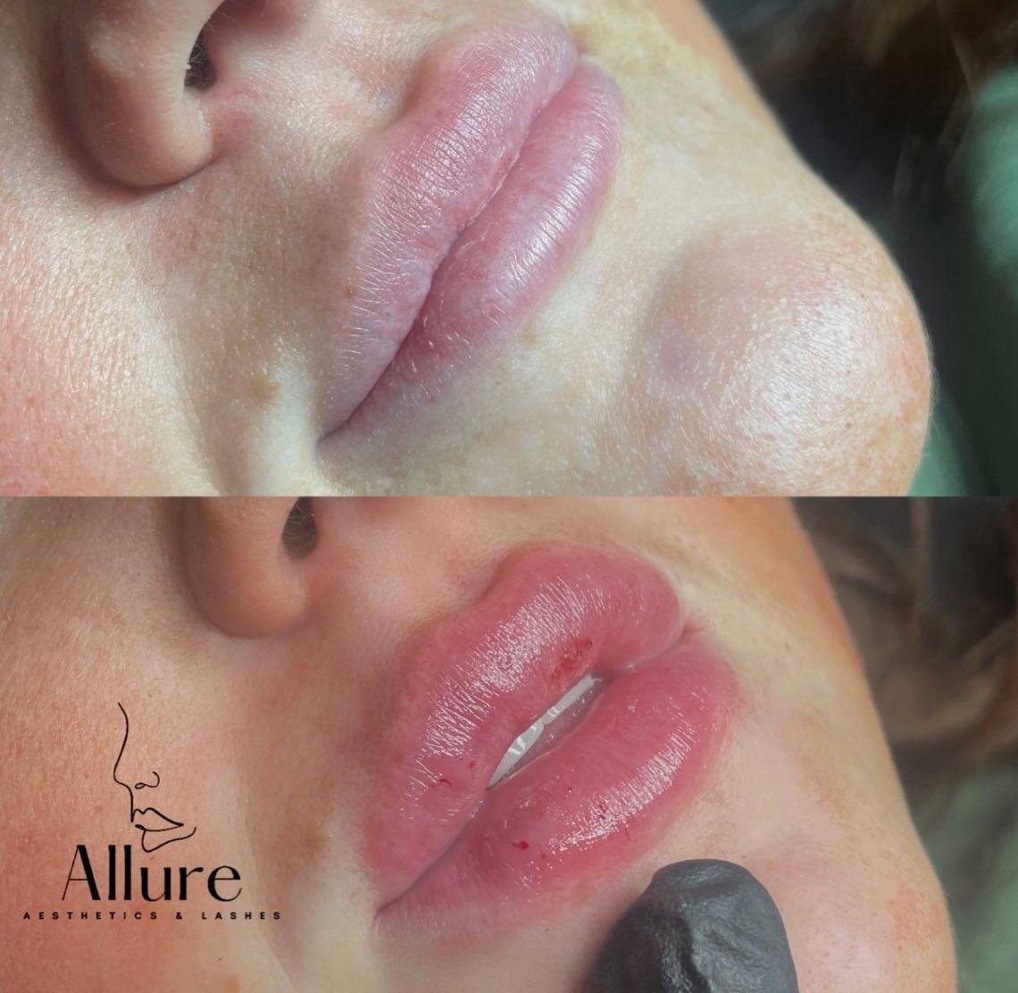 Allure Aesthetics image 2