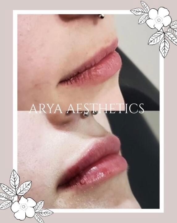 ARYA AESTHETICS image 1