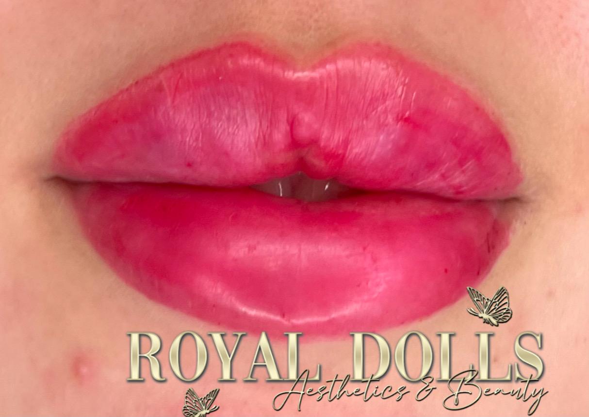 Royal Dolls Aesthetics image 2