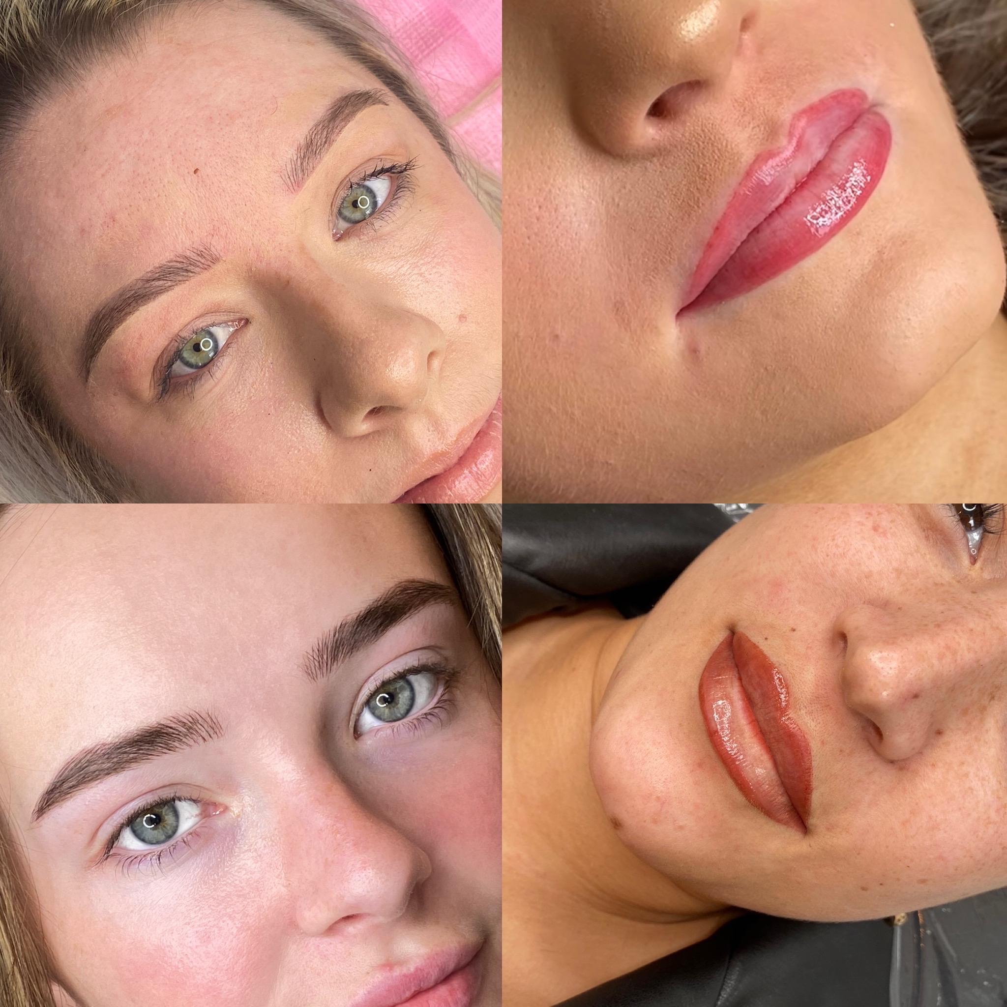 Lh brow clinic image 1