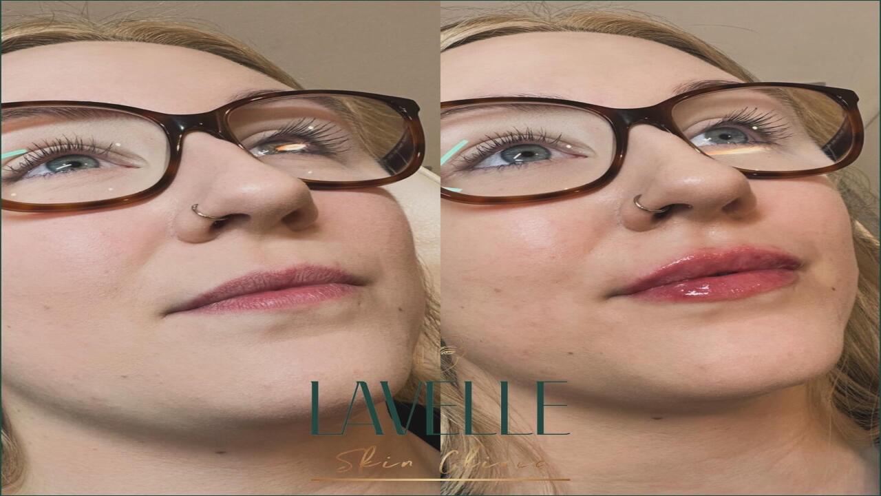 Lavelle Skin Clinic image 2