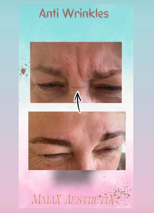 MMAX Aesthetix Bedford Clinic image 3