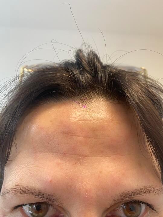 Beativu image 2