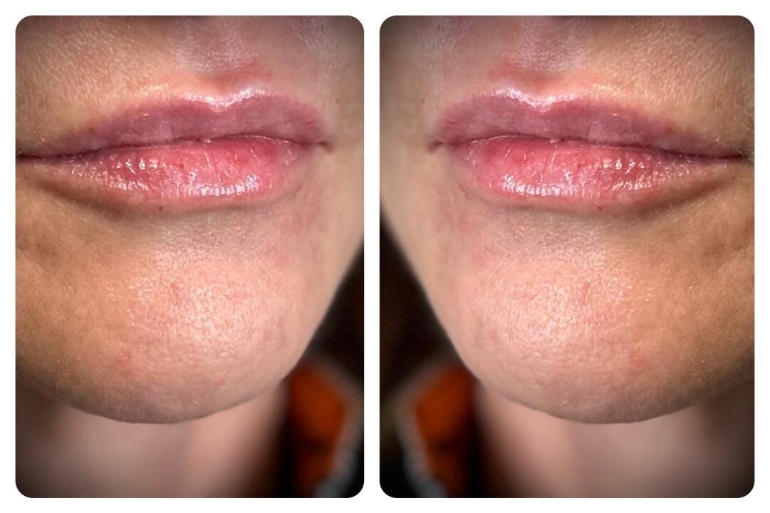 Refine Aesthetics image 2