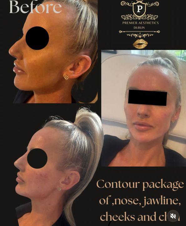 Premier aesthetics image 1