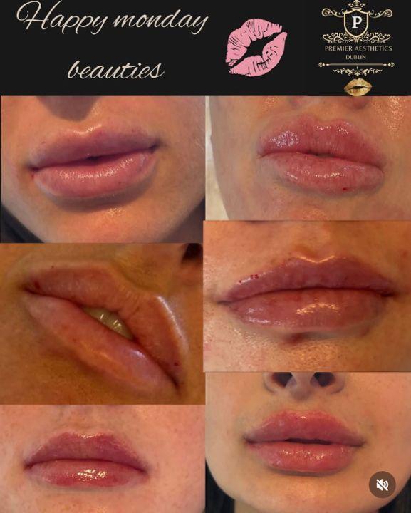 Premier aesthetics image 2