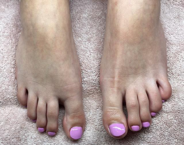 after Pedicure