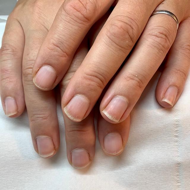 before Manicure treatment