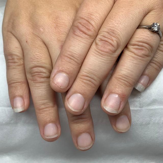 look before Manicure treatment