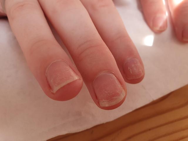 before Manicure