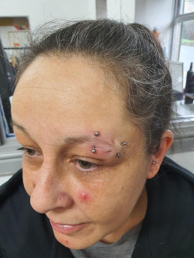 look after Nose Piercing treatment