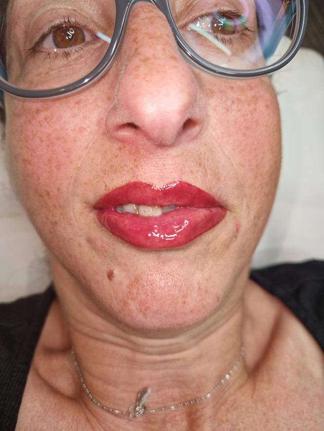 after Lip Tattoo