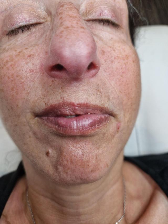 before Lip Tattoo