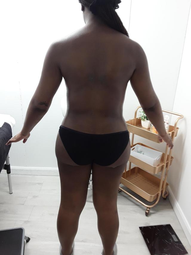 after Lymphatic Drainage Massage treatment