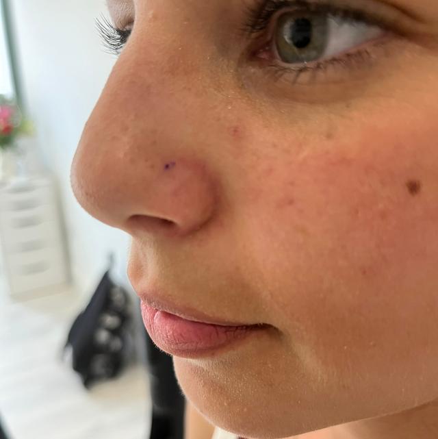 before Nose Piercing