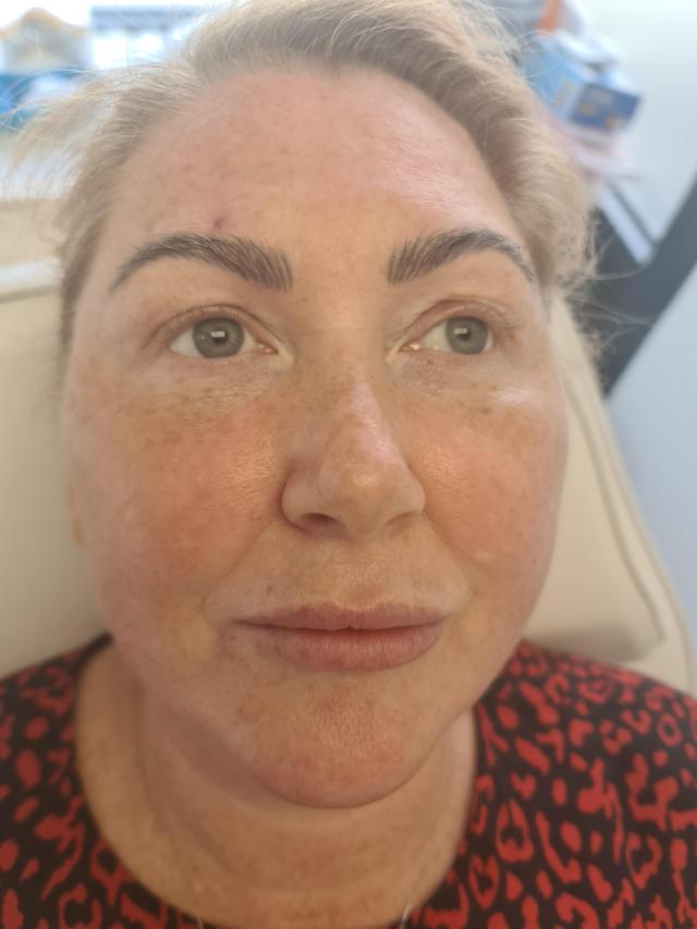 look before PRP treatment