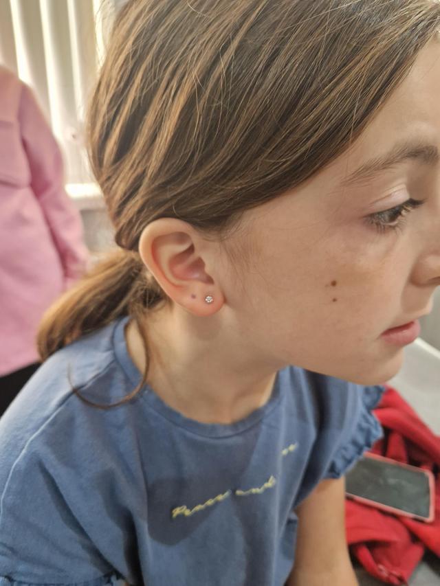 look before Ear Piercing treatment