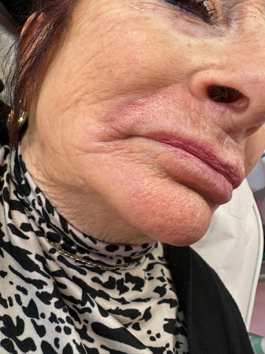 look after Lip Waxing treatment