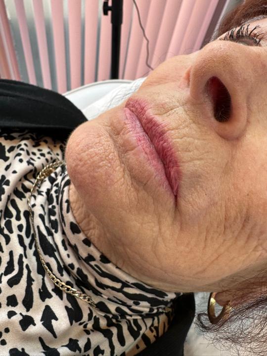 look before Lip Waxing treatment