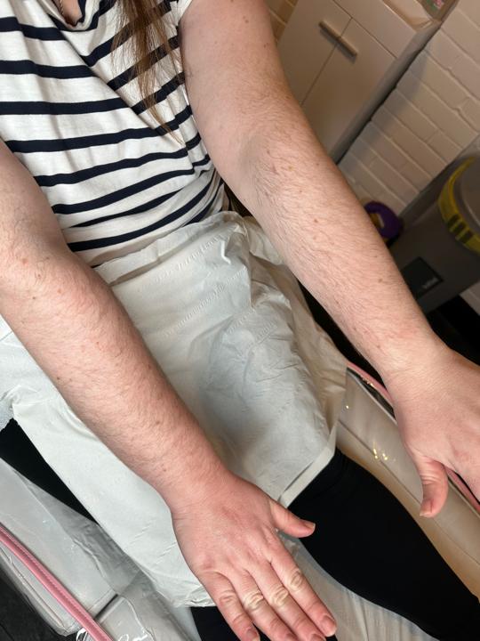 before Leg Wax treatment