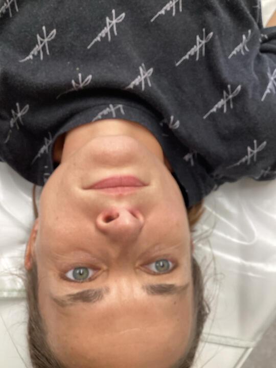 before Body Sculpting treatment