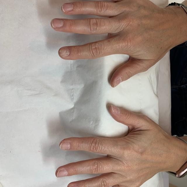 before Gel Nails