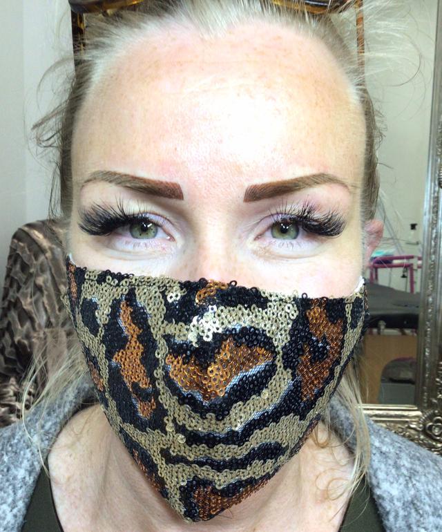 after Lip Tattoo treatment