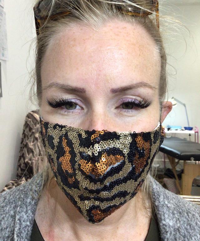 before Lip Tattoo treatment