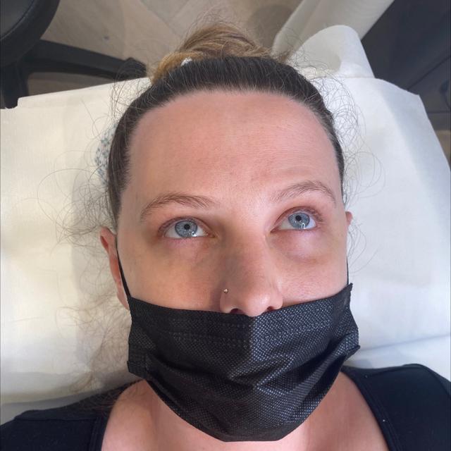 look before LVL Lashes treatment
